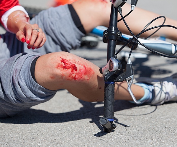 Los Angeles Bicycle Accident Attorney for Serious Bike Crashes